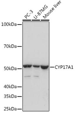 Western blot - CYP17A1 Rabbit mAb (A5067)