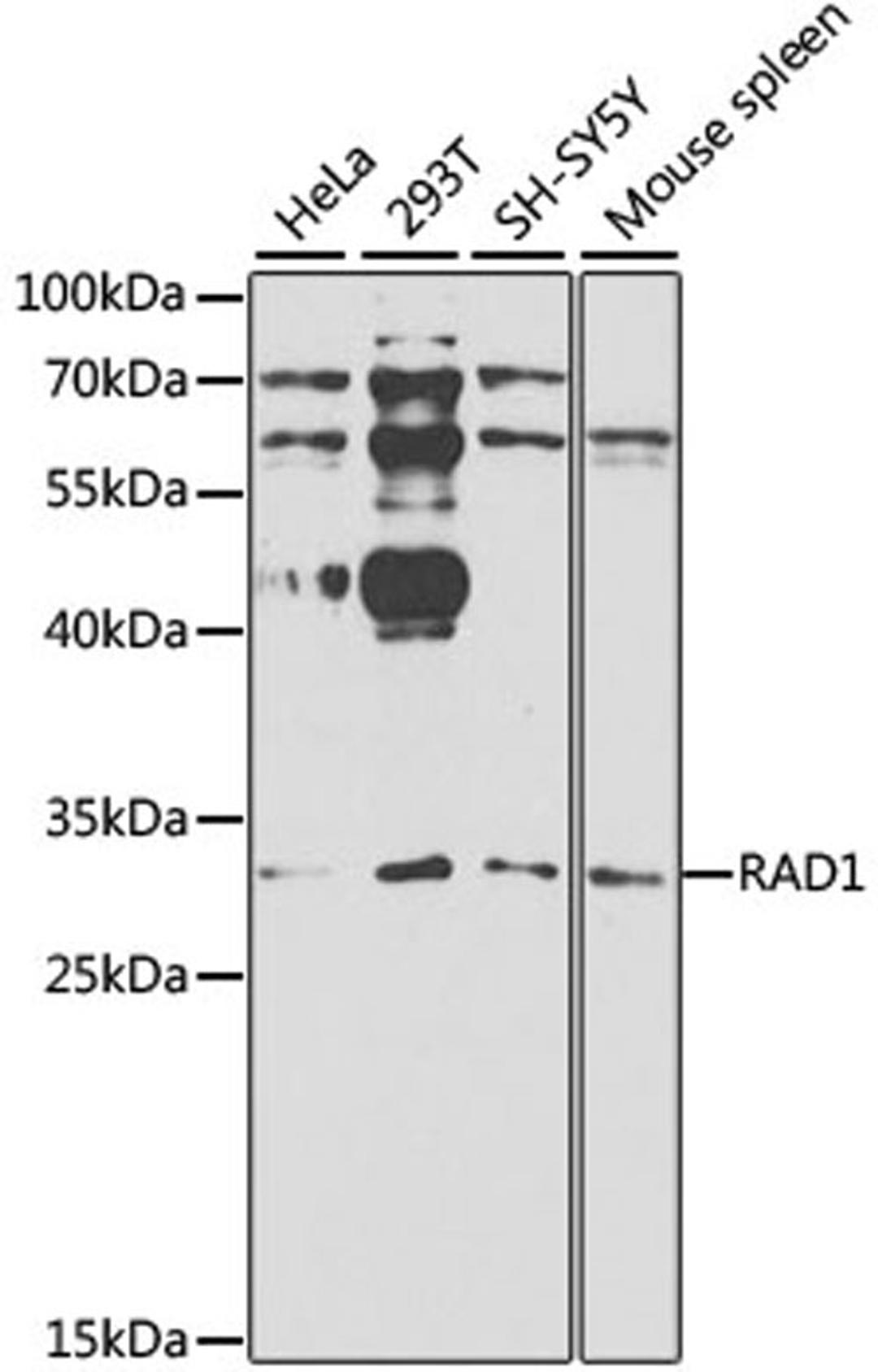 Western blot - RAD1 antibody (A1047)