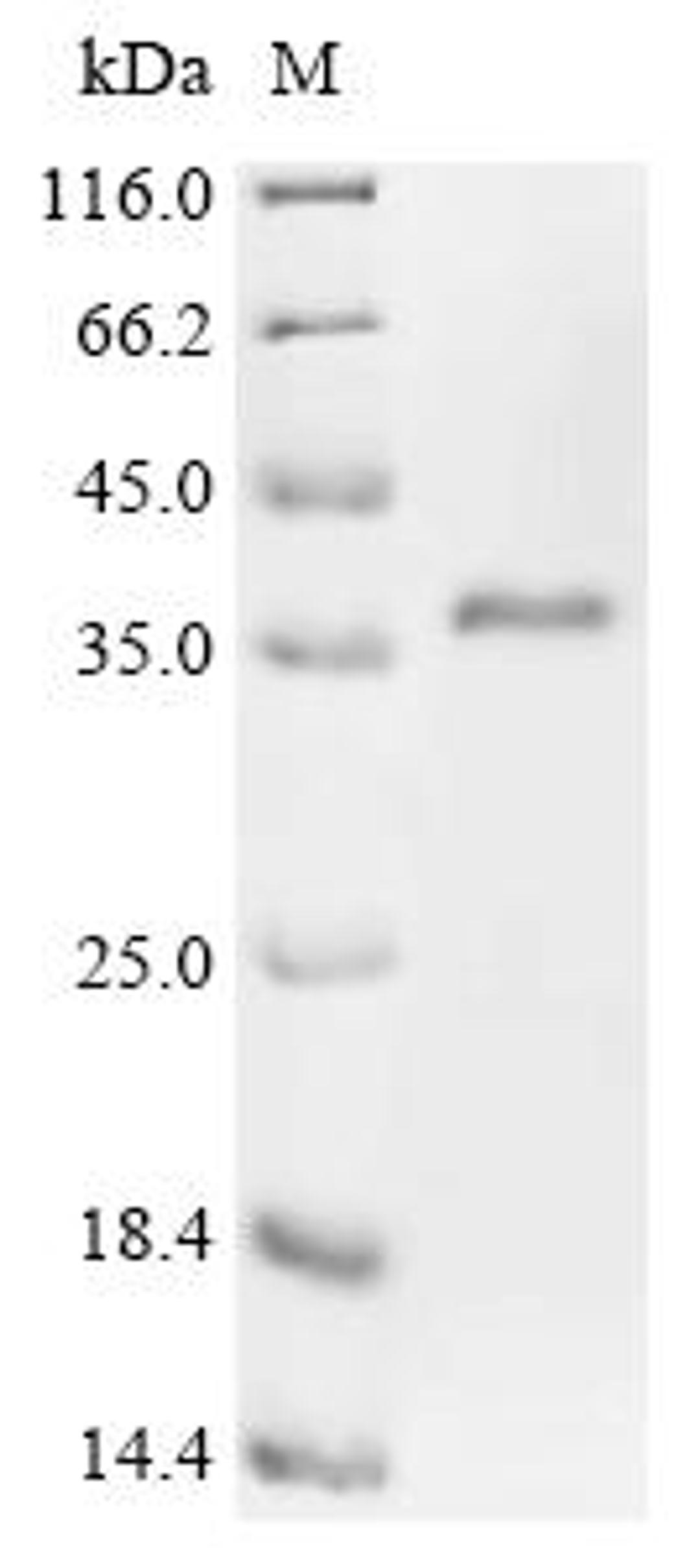 (Tris-Glycine gel) Discontinuous SDS-PAGE (reduced) with 5% enrichment gel and 15% separation gel.