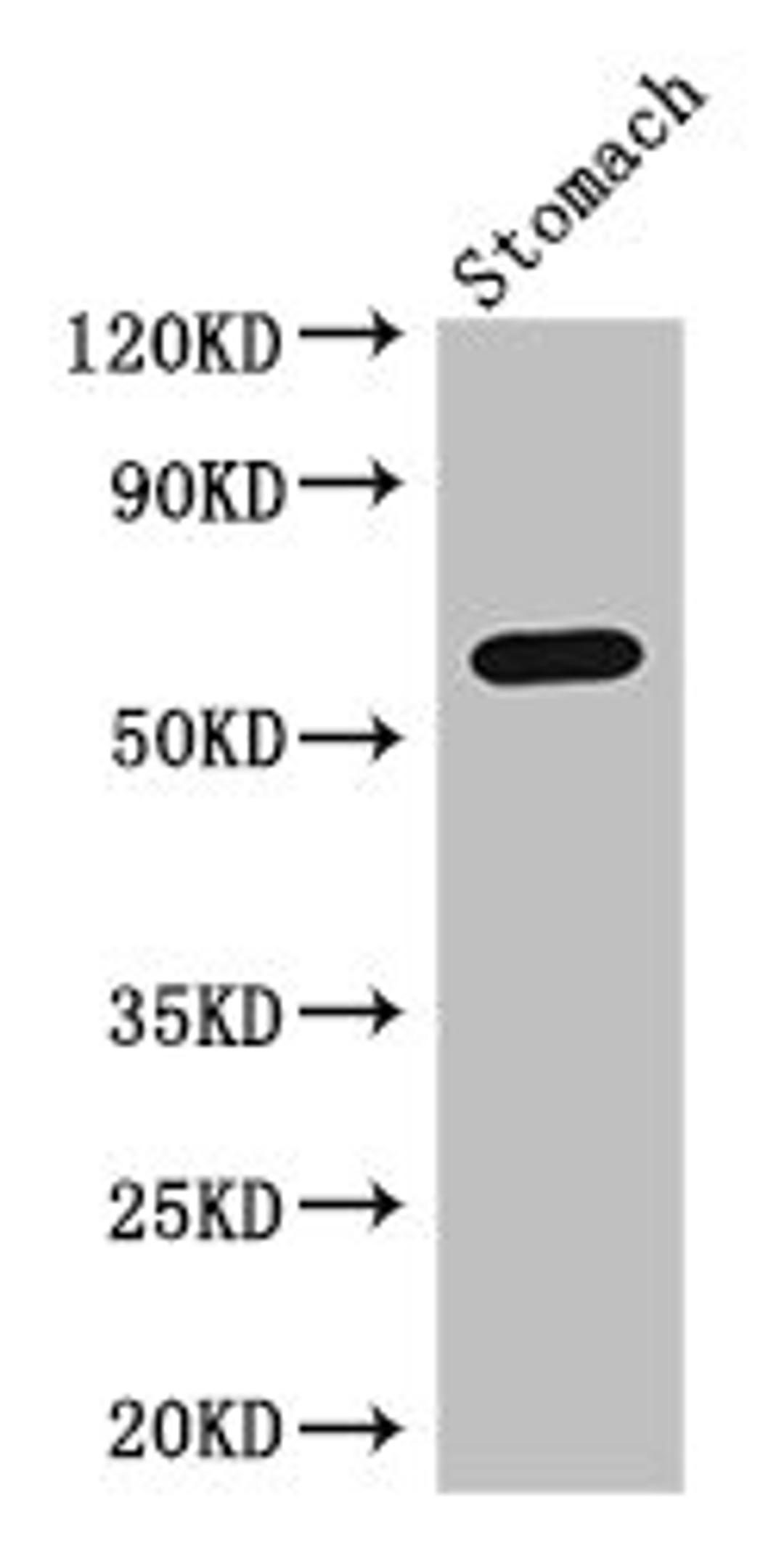 Western Blot. Positive WB detected in: Mouse stomach tissue. All lanes: IL4I1 antibody at 3ug/ml. Secondary. Goat polyclonal to rabbit IgG at 1/50000 dilution. Predicted band size: 63, 66 kDa. Observed band size: 63 kDa. 