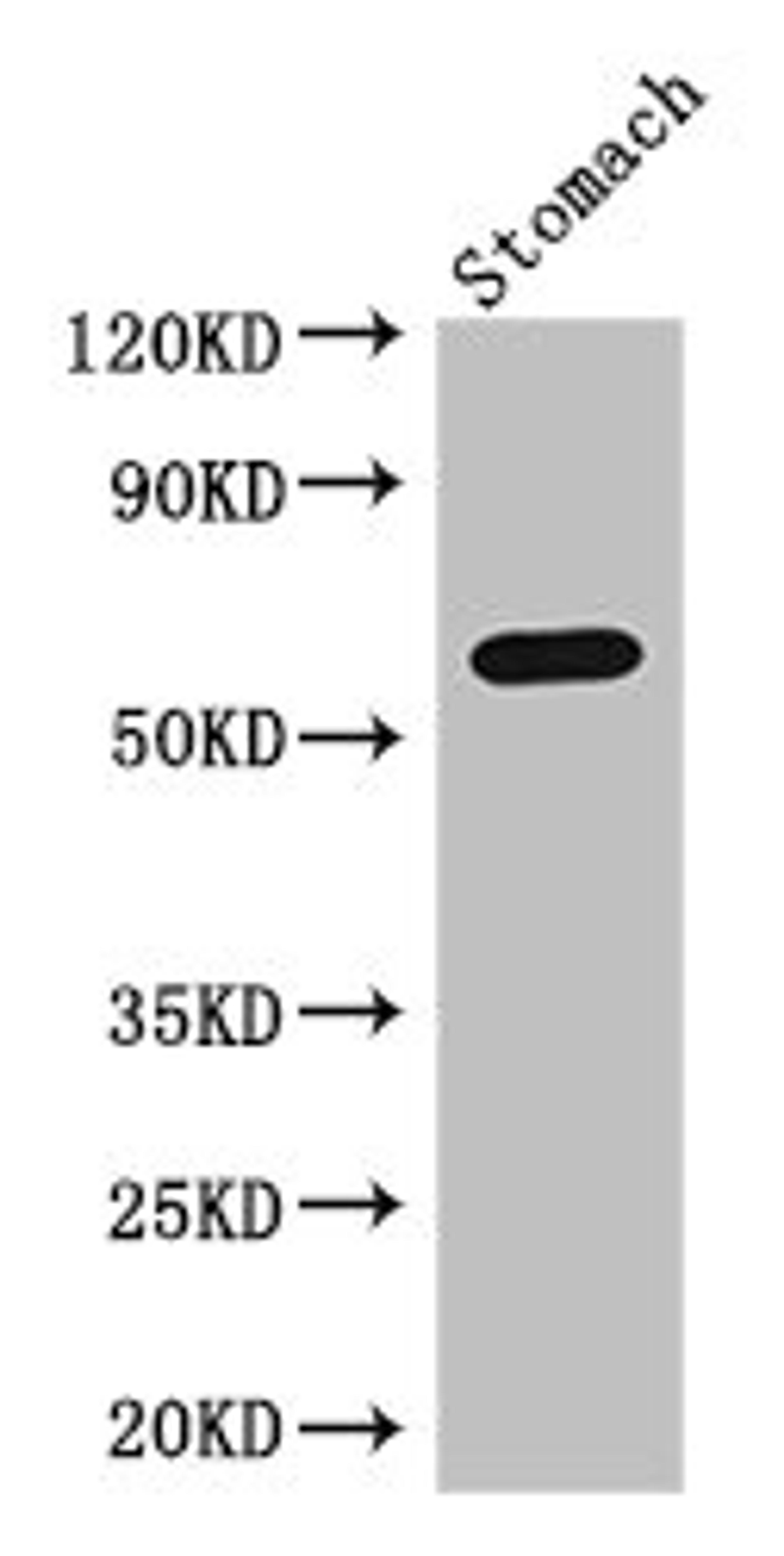Western Blot. Positive WB detected in: Mouse stomach tissue. All lanes: IL4I1 antibody at 3ug/ml. Secondary. Goat polyclonal to rabbit IgG at 1/50000 dilution. Predicted band size: 63, 66 kDa. Observed band size: 63 kDa. 