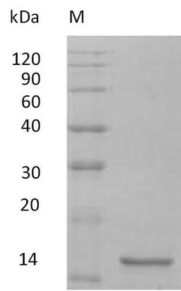 (Tris-Glycine gel) Discontinuous SDS-PAGE (reduced) with 5% enrichment gel and 15% separation gel.