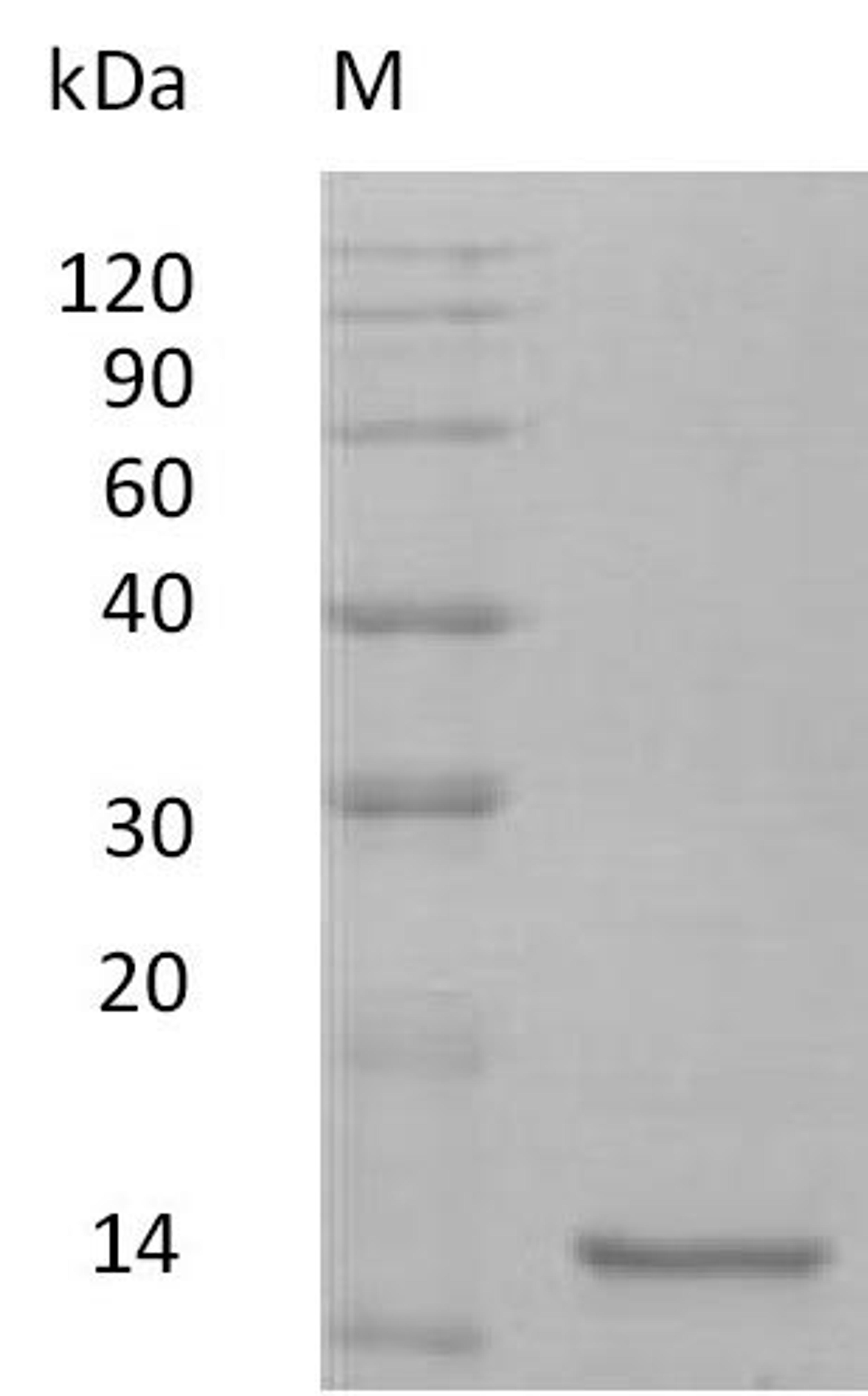 (Tris-Glycine gel) Discontinuous SDS-PAGE (reduced) with 5% enrichment gel and 15% separation gel.