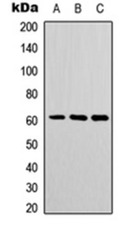 Western blot analysis of COLO205 (Lane 1), mouse spleen (Lane 2), mouse heart (Lane 3) whole cell lysates using POTEH antibody