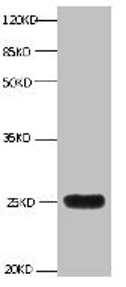 All lanes:Mouse anti-human Neutrophil gelatinase-associated lipocalin monoclonal antibody at 1ug/ml. Lane 1:NGAL transfected 293 cell lysate. Predicted band size : 22 kDa. Observed band size : 25 kDa. 