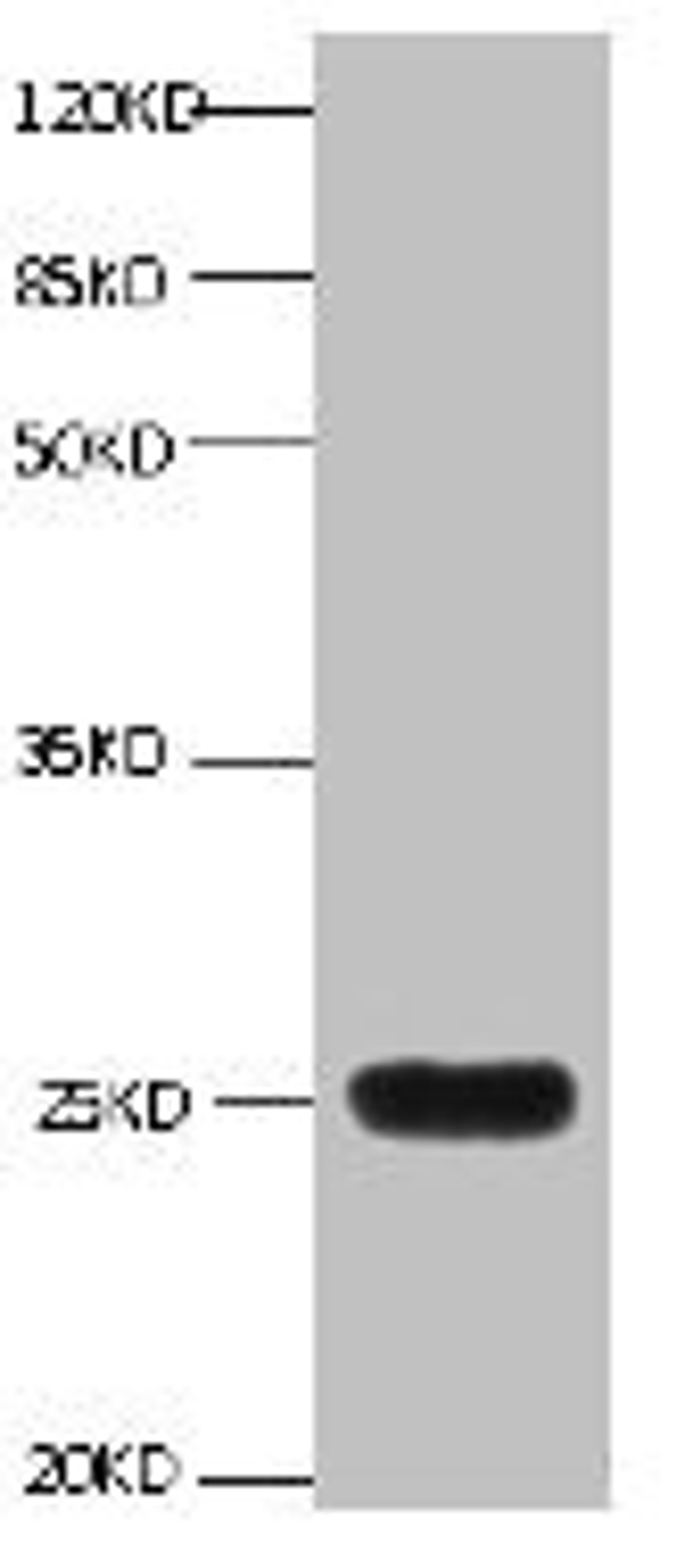 All lanes:Mouse anti-human Neutrophil gelatinase-associated lipocalin monoclonal antibody at 1ug/ml. Lane 1:NGAL transfected 293 cell lysate. Predicted band size : 22 kDa. Observed band size : 25 kDa. 