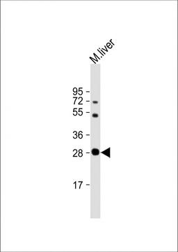 Western Blot at 1:64000 dilution + mouse liver lysate Lysates/proteins at 20 ug per lane.