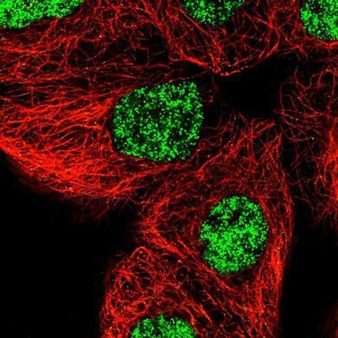 Immunocytochemistry/Immunofluorescence: WDR57 Antibody [NBP1-92585] - Staining of human cell line A-431 shows positivity in nucleus but not nucleoli.