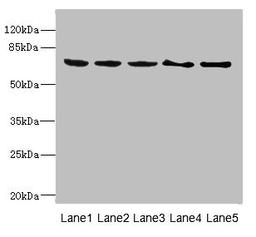 Western blot. All lanes: PLK3 antibody at 1.2ug/ml. Lane 1: Rat heart tissue. Lane 2: Hela whole cell lysate. Lane 3: 293T whole cell lysate. Lane 4: MCF-7 whole cell lysate. Lane 5: Monocytic leukemia cells in mice Macrophages. Secondary. Goat polyclonal to rabbit IgG at 1/10000 dilution. Predicted band size: 72 kDa. Observed band size: 72 kDa. 