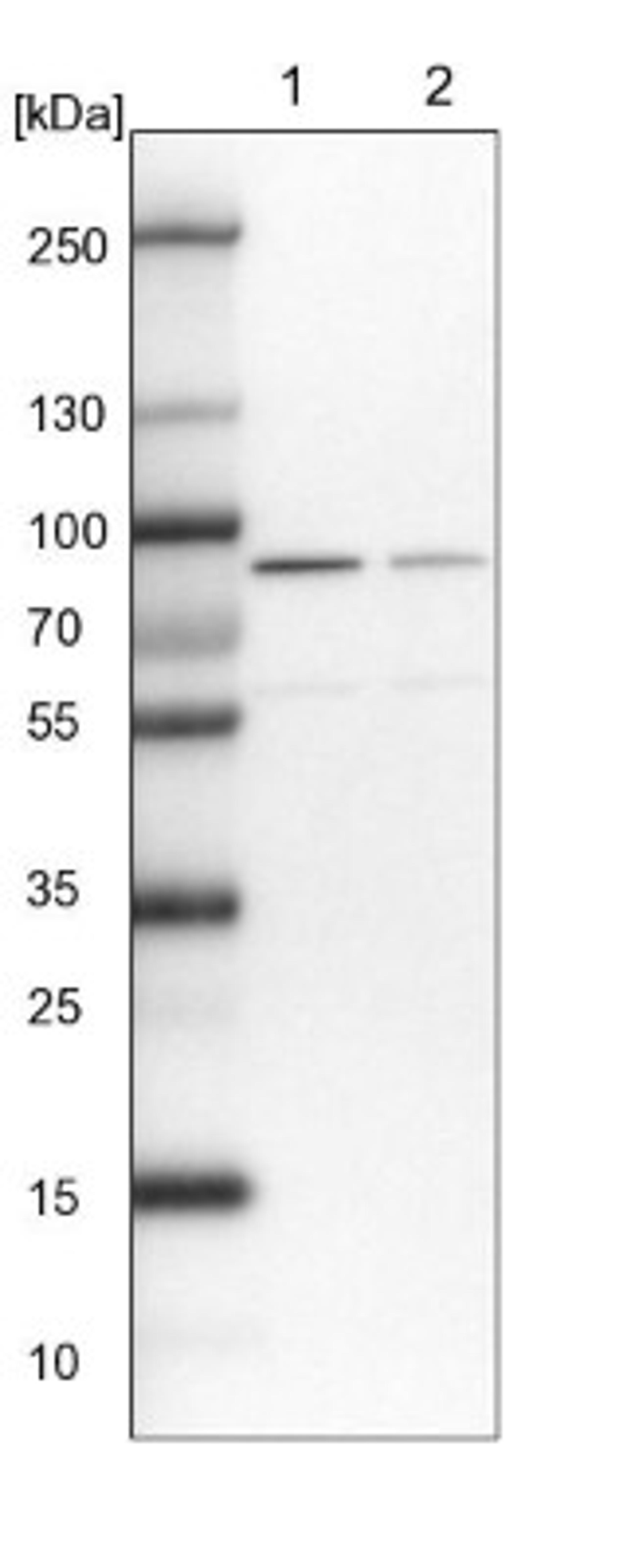 Western Blot: DHX15 Antibody [NBP2-13919] - Lane 1: NIH-3T3 cell lysate (Mouse embryonic fibroblast cells)<br/>Lane 2: NBT-II cell lysate (Rat Wistar bladder tumour cells)