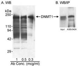 Detection of human DNMT1 by western blot and immunoprecipitation.