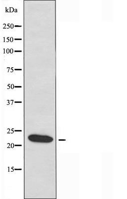 Western blot analysis of HUVEC cells and COLO cells using ERD22 antibody