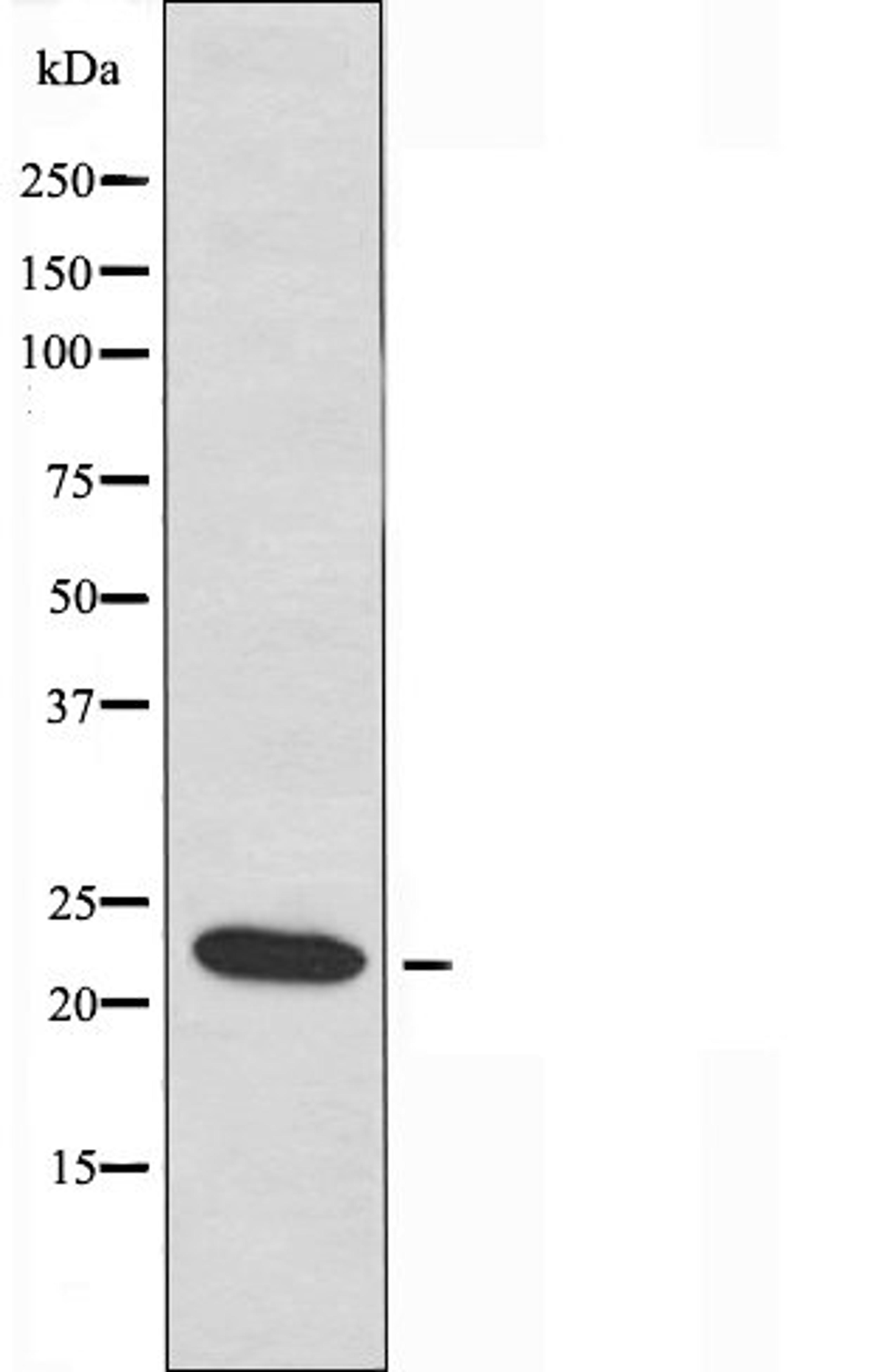 Western blot analysis of HUVEC cells and COLO cells using ERD22 antibody