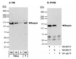 Western Blot: Roquin Antibody [NB100-655] - Detection of human Roquin on HeLa whole cell lysate using NB100-655. Roquin was also immunoprecipitated using NB100-656 at 3 ug/mg lysate.