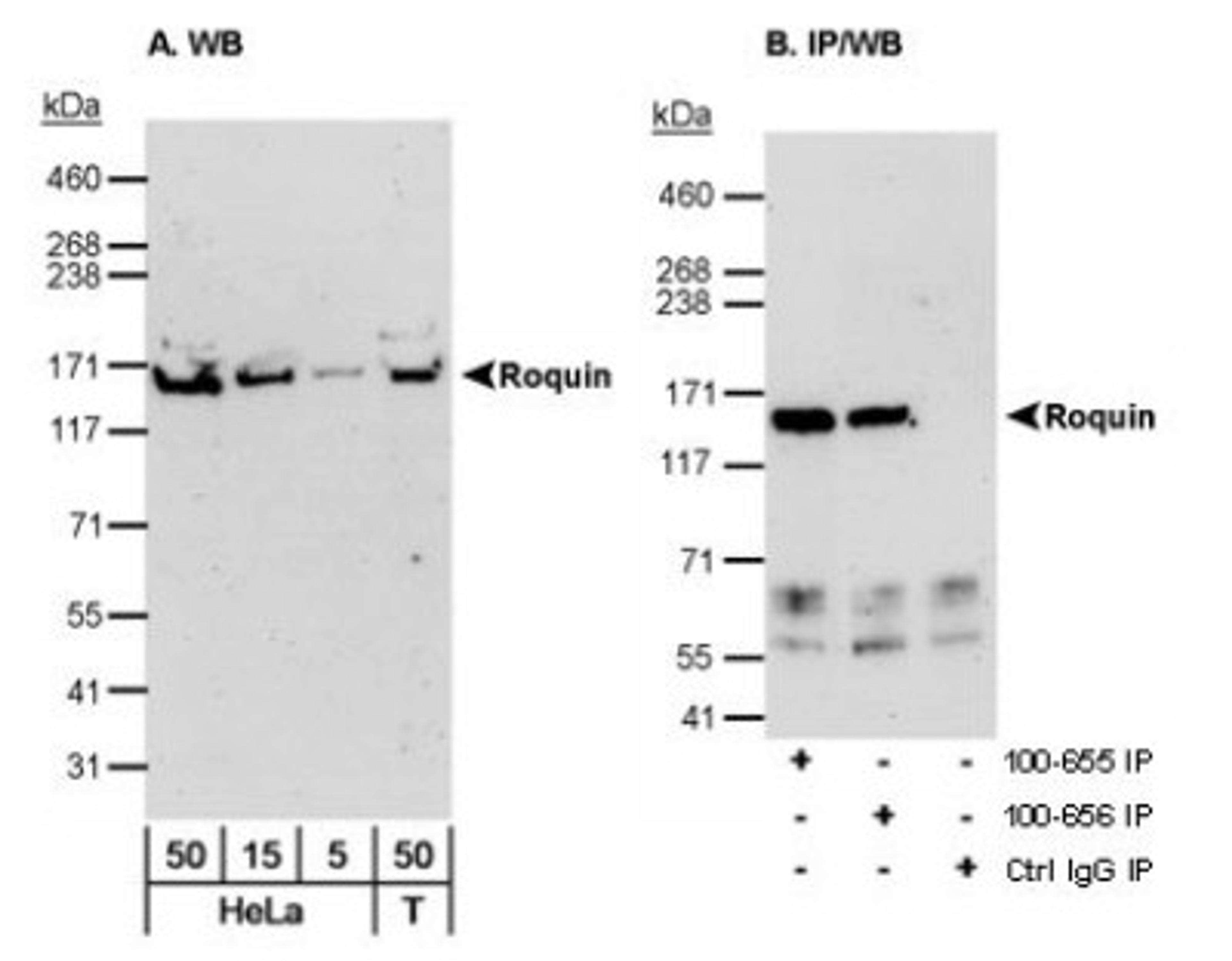 Western Blot: Roquin Antibody [NB100-655] - Detection of human Roquin on HeLa whole cell lysate using NB100-655. Roquin was also immunoprecipitated using NB100-656 at 3 ug/mg lysate.