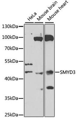 Western blot - SMYD3 antibody (A7309)