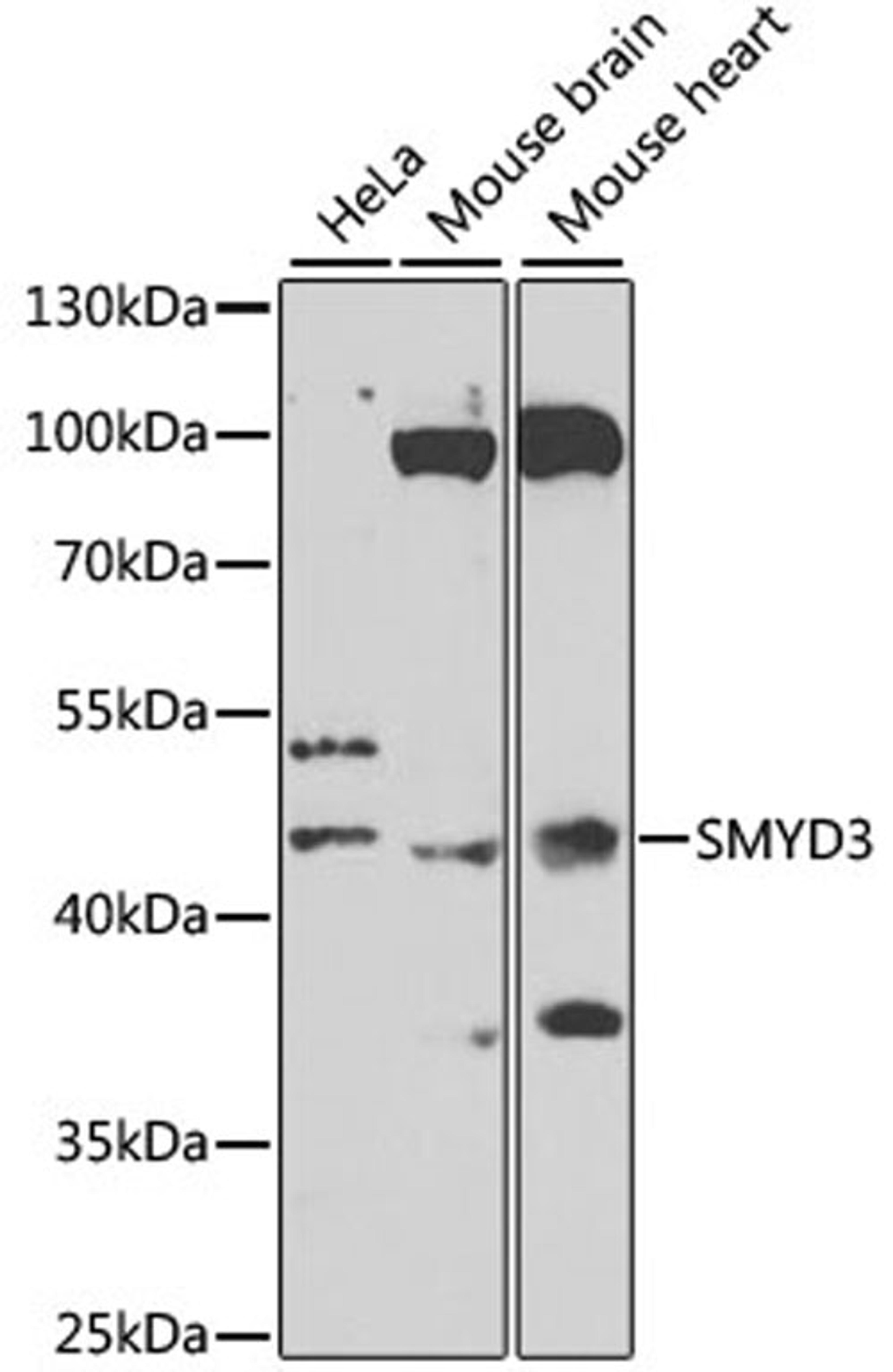 Western blot - SMYD3 antibody (A7309)