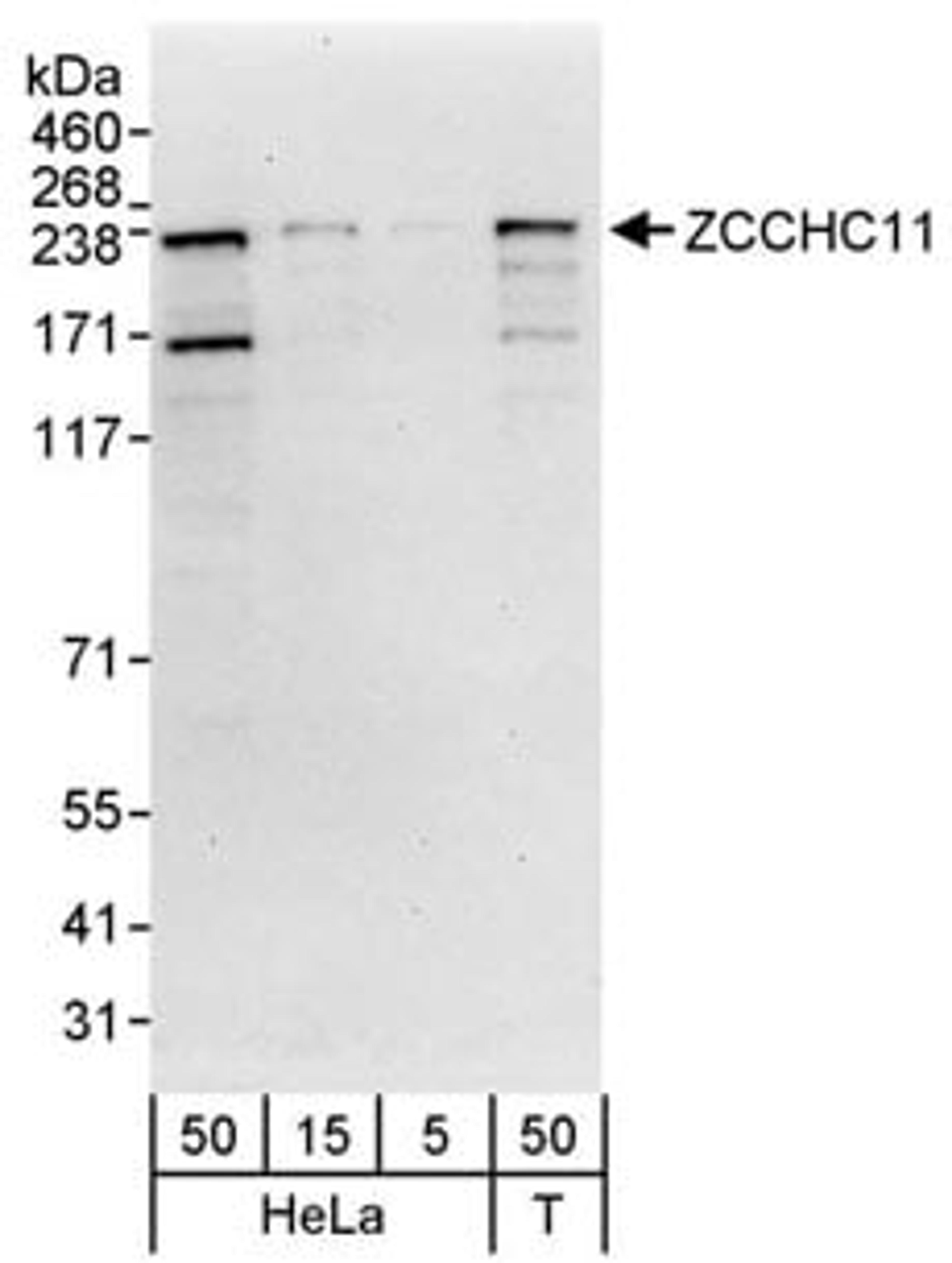 Detection of human ZCCHC11 by western blot.