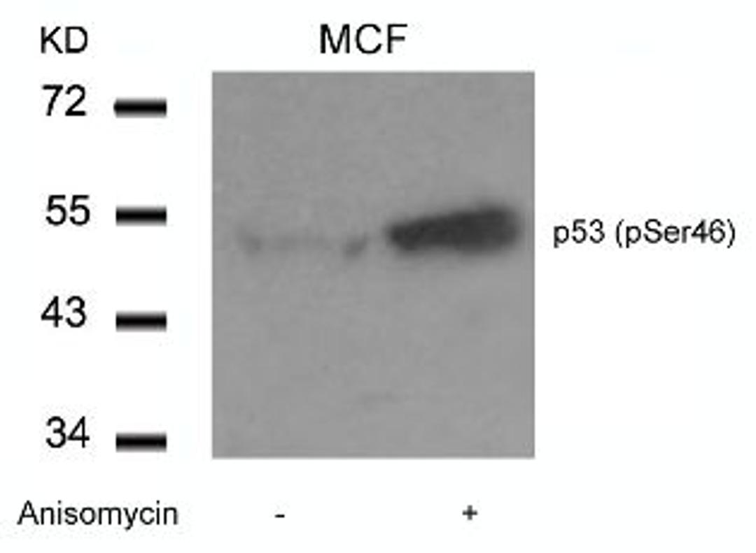 Western blot analysis of lysed extracts from MCF cells untreated or treated with Anisomycin using p53 (Phospho-Ser46).