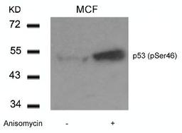 Western blot analysis of lysed extracts from MCF cells untreated or treated with Anisomycin using p53 (Phospho-Ser46).