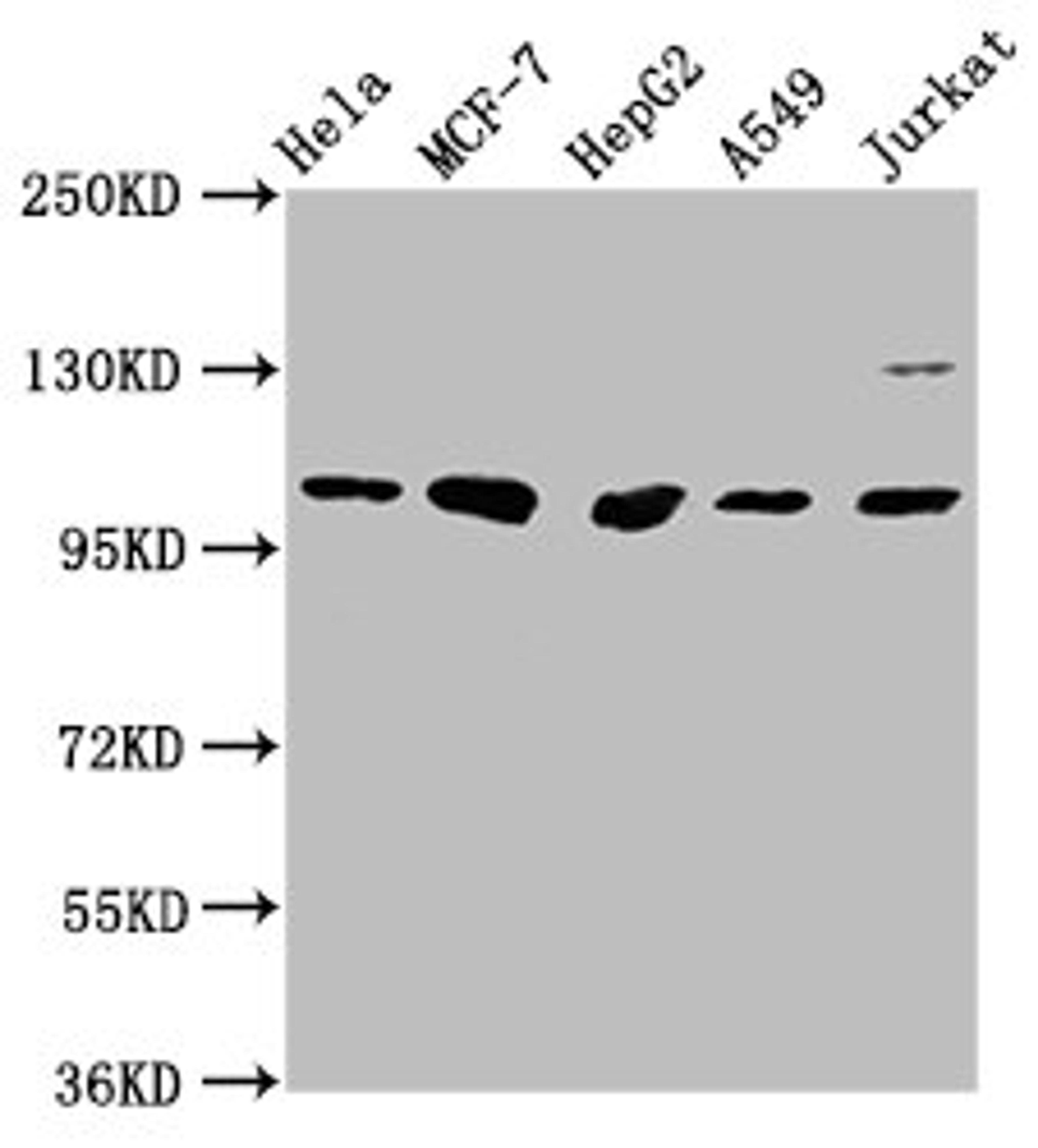 Western Blot. Positive WB detected in: Hela whole cell lysate, MCF-7 whole cell lysate, HepG2 whole cell lysate, A549 whole cell lysate, Jurkat whole cell lysate. All lanes: GANC antibody at 1:1000. Secondary. Goat polyclonal to rabbit IgG at 1/50000 dilution. Predicted band size: 105 kDa. Observed band size: 105 kDa