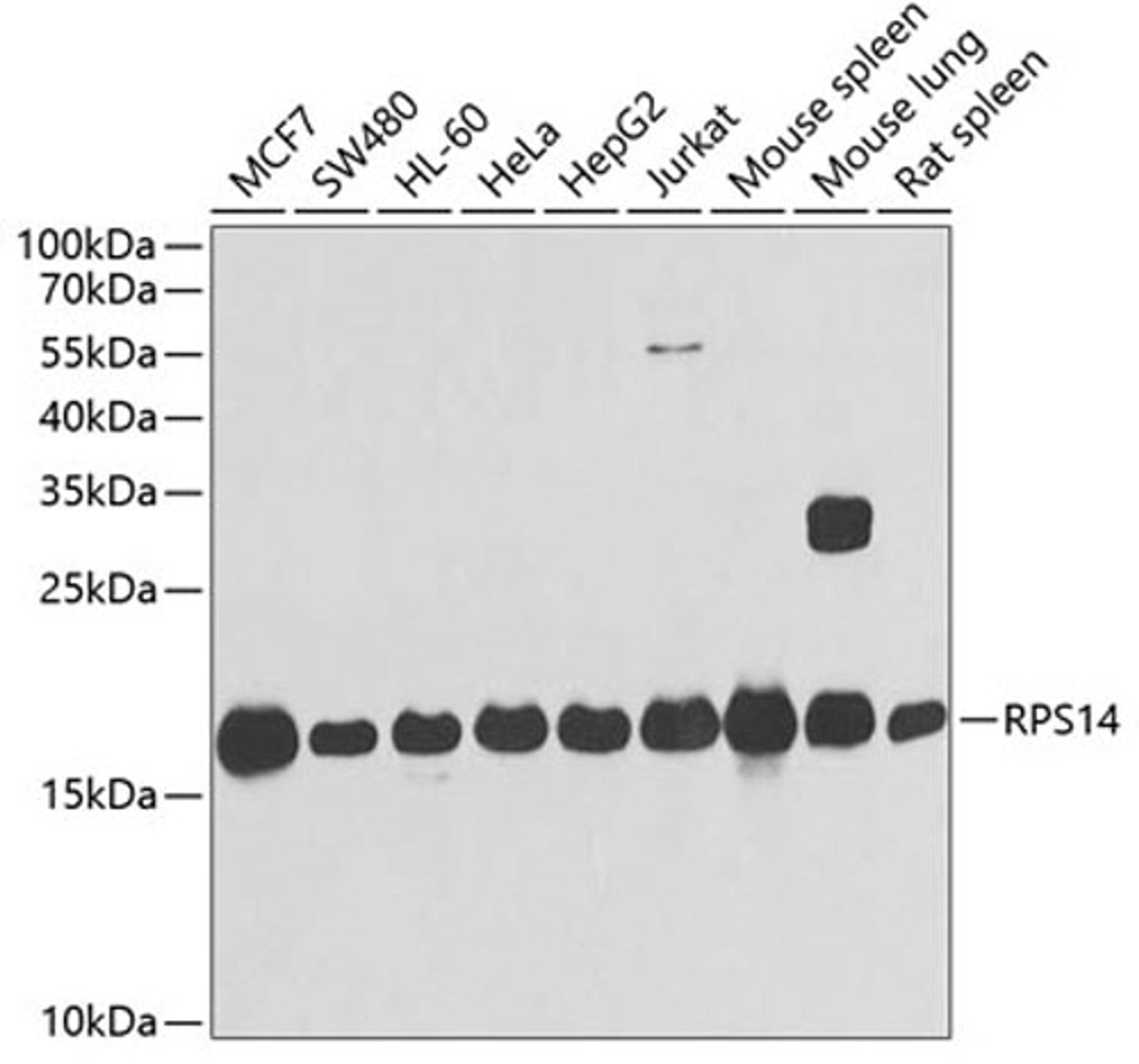 Western blot - RPS14 antibody (A6727)