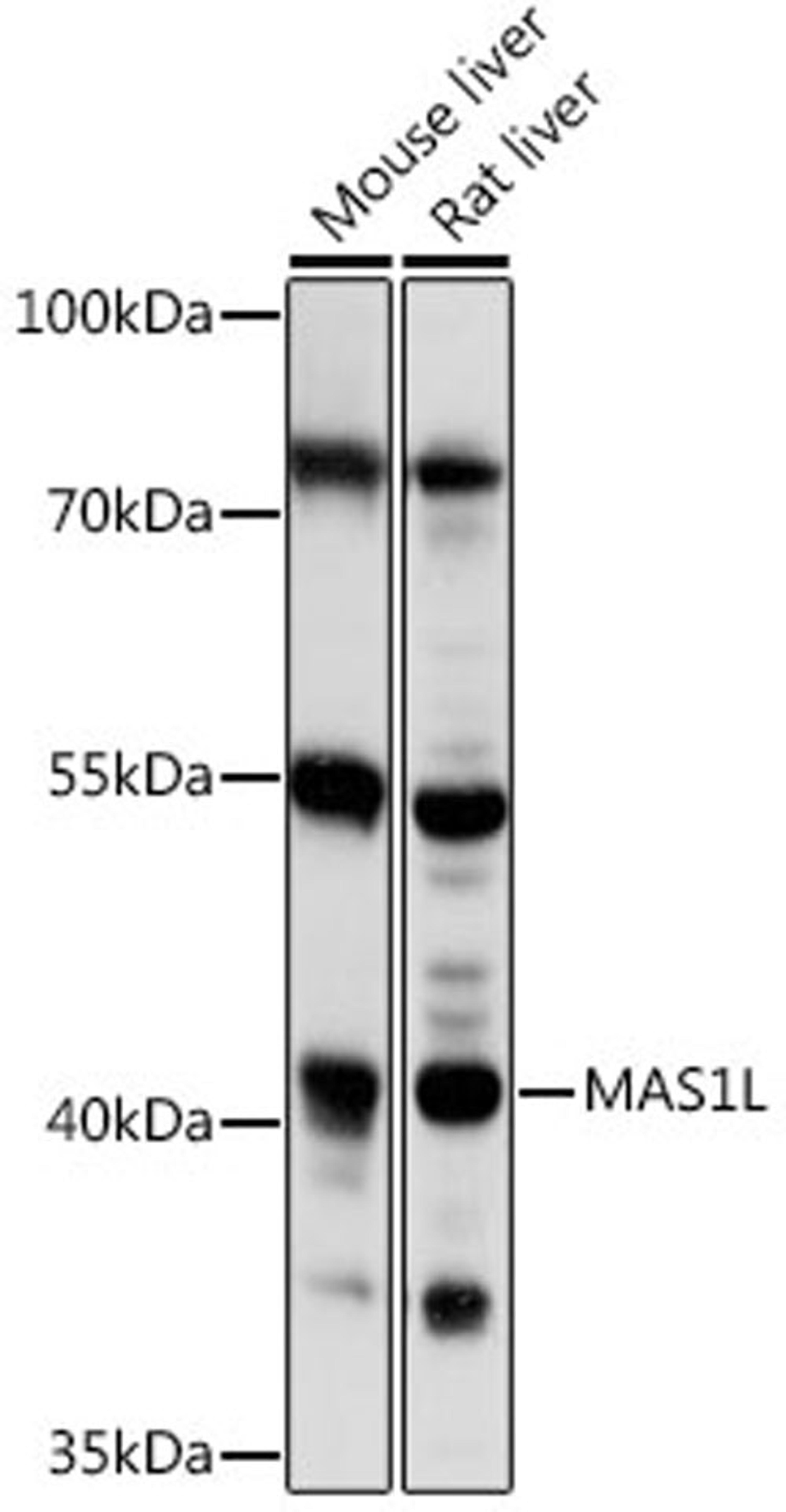 Western blot - MAS1L antibody (A16162)