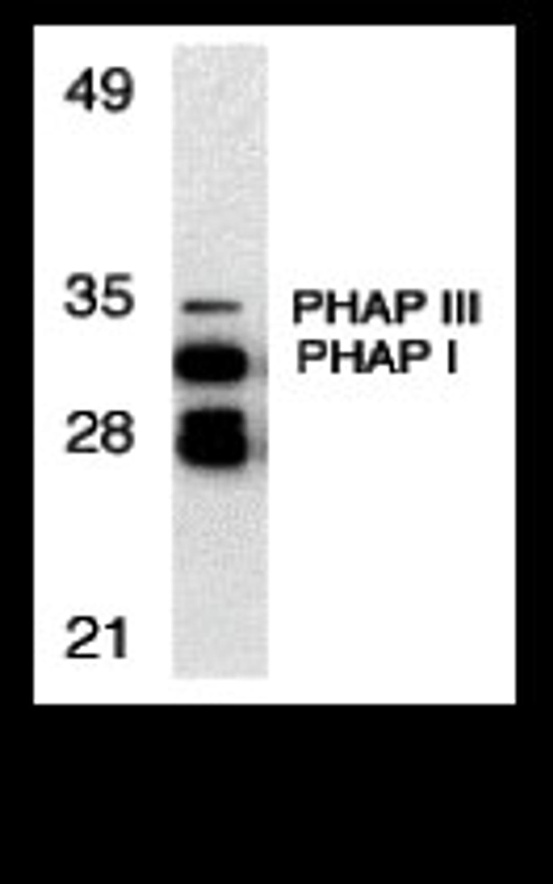 Western blot analysis of PHAP expression in human Raji cell llysate with PHAP antibody at 1 μg/mL.
