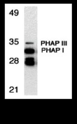 Western blot analysis of PHAP expression in human Raji cell llysate with PHAP antibody at 1 μg/mL.