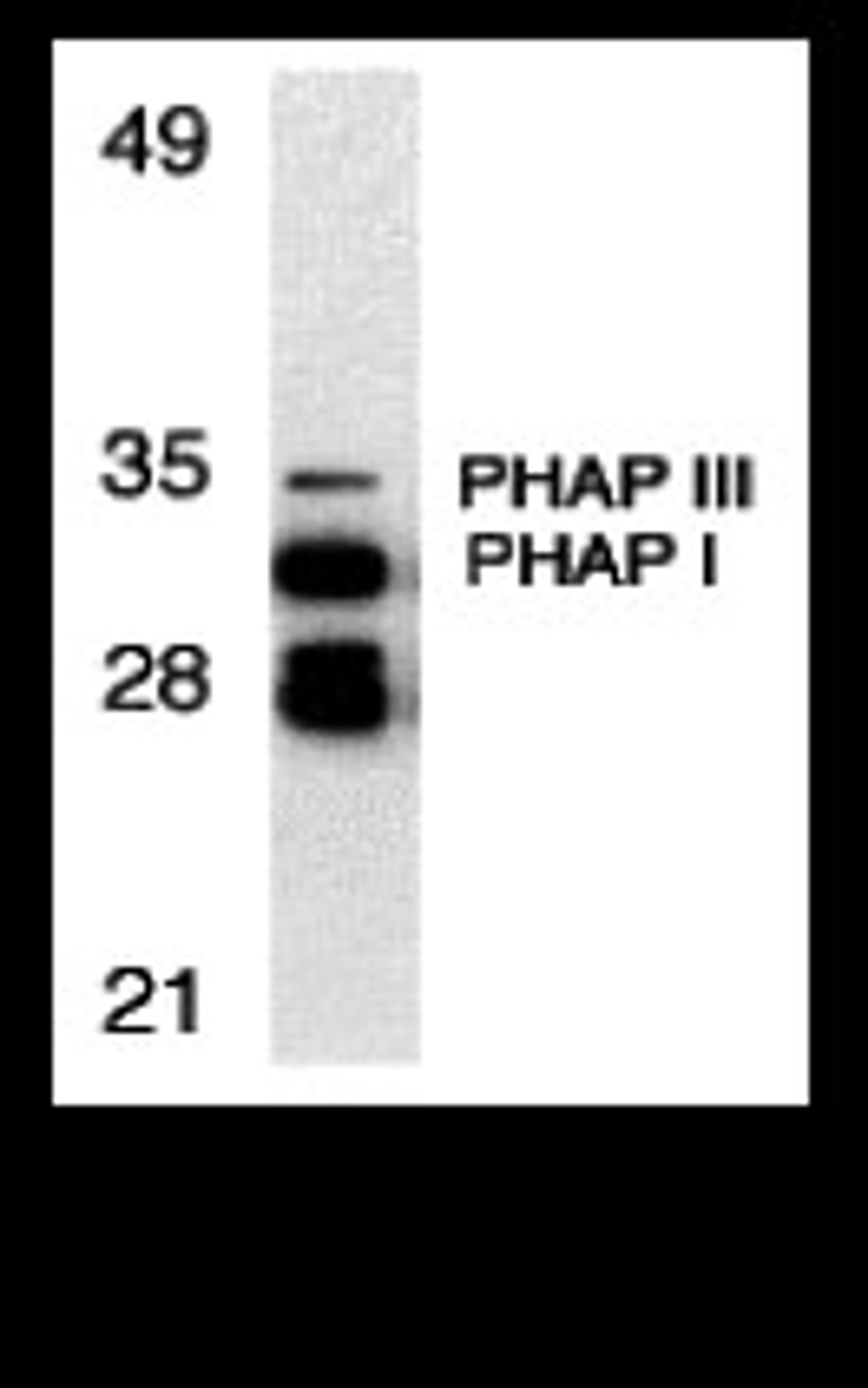 Western blot analysis of PHAP expression in human Raji cell llysate with PHAP antibody at 1 μg/mL.