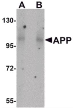 Western blot analysis of APP in mouse brain tissue lysate with APP antibody at (A) 1 and (B) 2 &#956;g/mL.