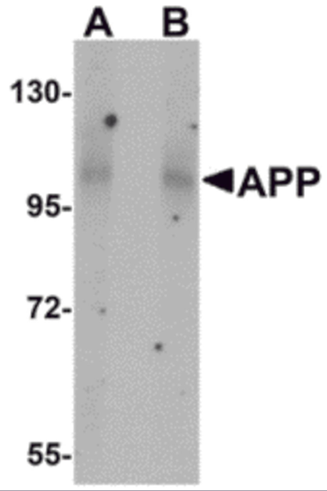Western blot analysis of APP in mouse brain tissue lysate with APP antibody at (A) 1 and (B) 2 μg/mL.