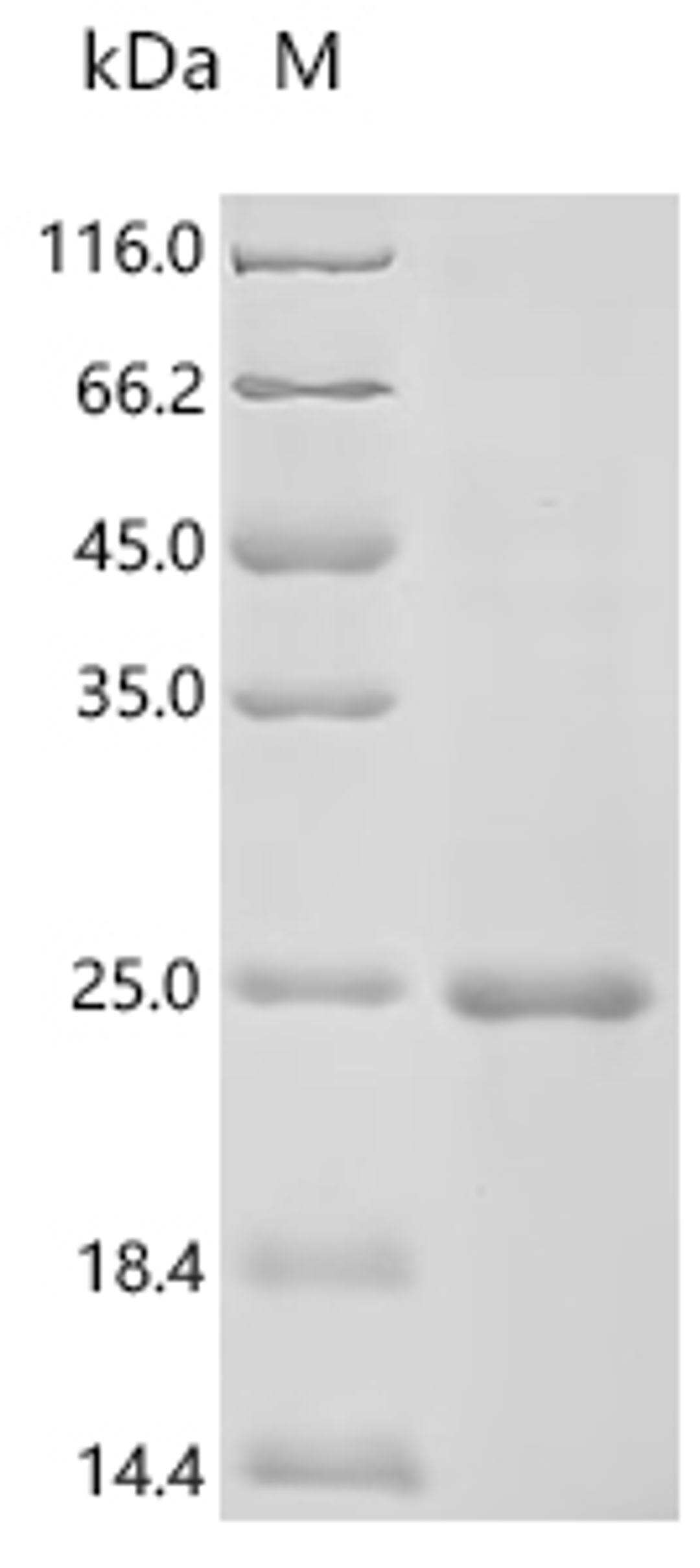 (Tris-Glycine gel) Discontinuous SDS-PAGE (reduced) with 5% enrichment gel and 15% separation gel.