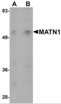 Western blot analysis of MATN1 in mouse liver tissue lysate with MATN1 antibody at (A) 1 and (B) 2 &#956;g/mL.