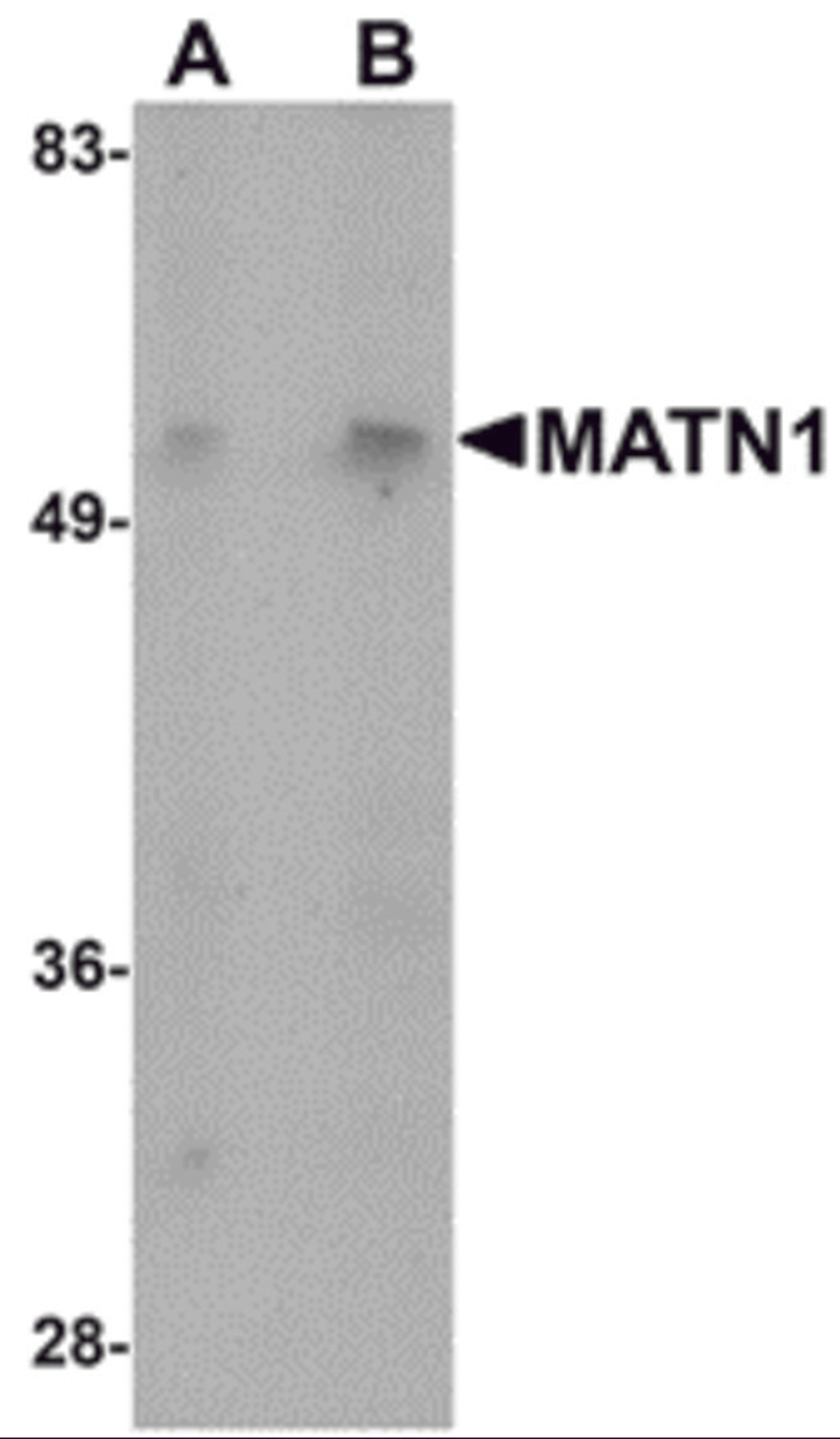 Western blot analysis of MATN1 in mouse liver tissue lysate with MATN1 antibody at (A) 1 and (B) 2 μg/mL.
