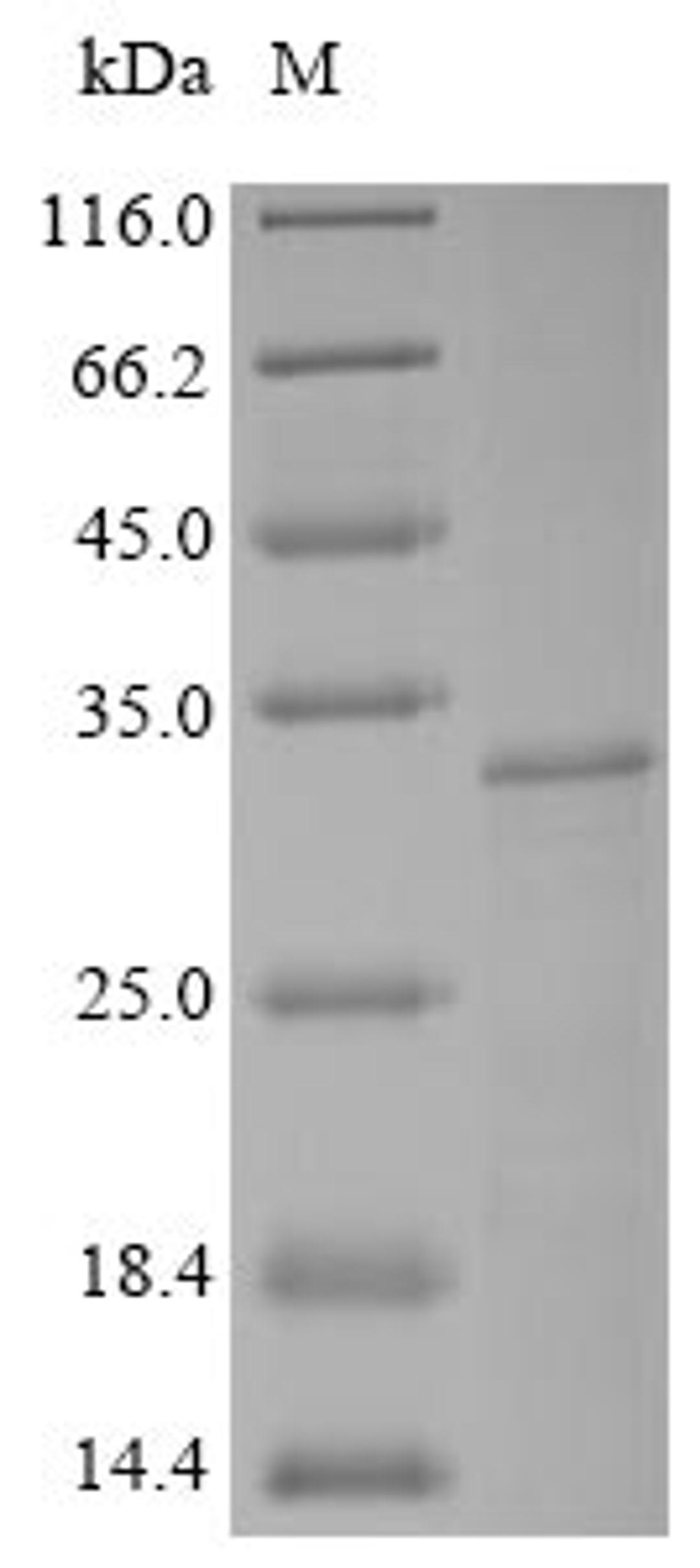 (Tris-Glycine gel) Discontinuous SDS-PAGE (reduced) with 5% enrichment gel and 15% separation gel.