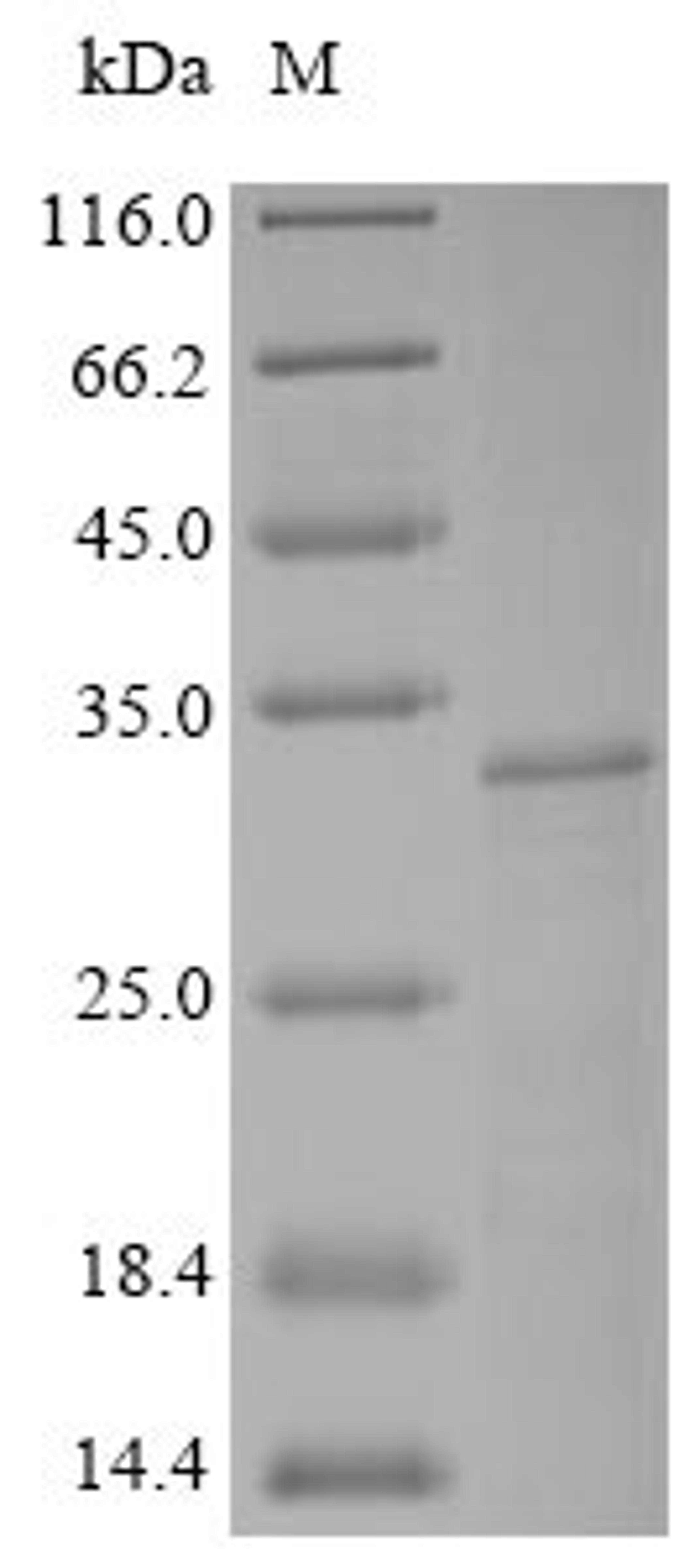 (Tris-Glycine gel) Discontinuous SDS-PAGE (reduced) with 5% enrichment gel and 15% separation gel.