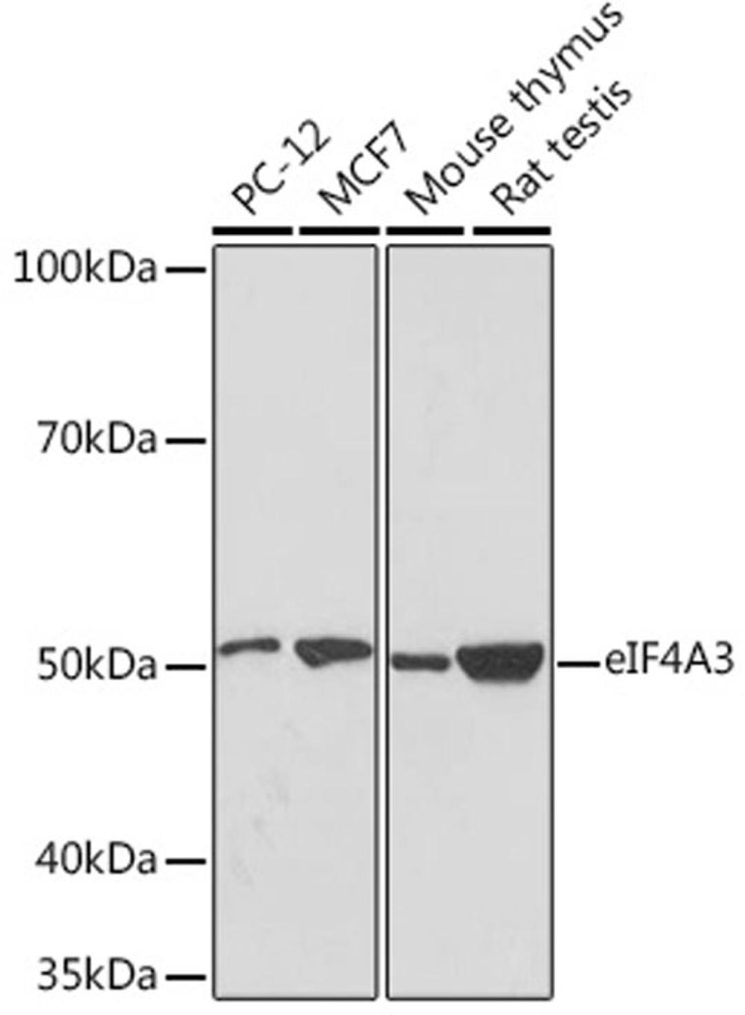 Western blot - eIF4A3 Rabbit mAb (A8985)