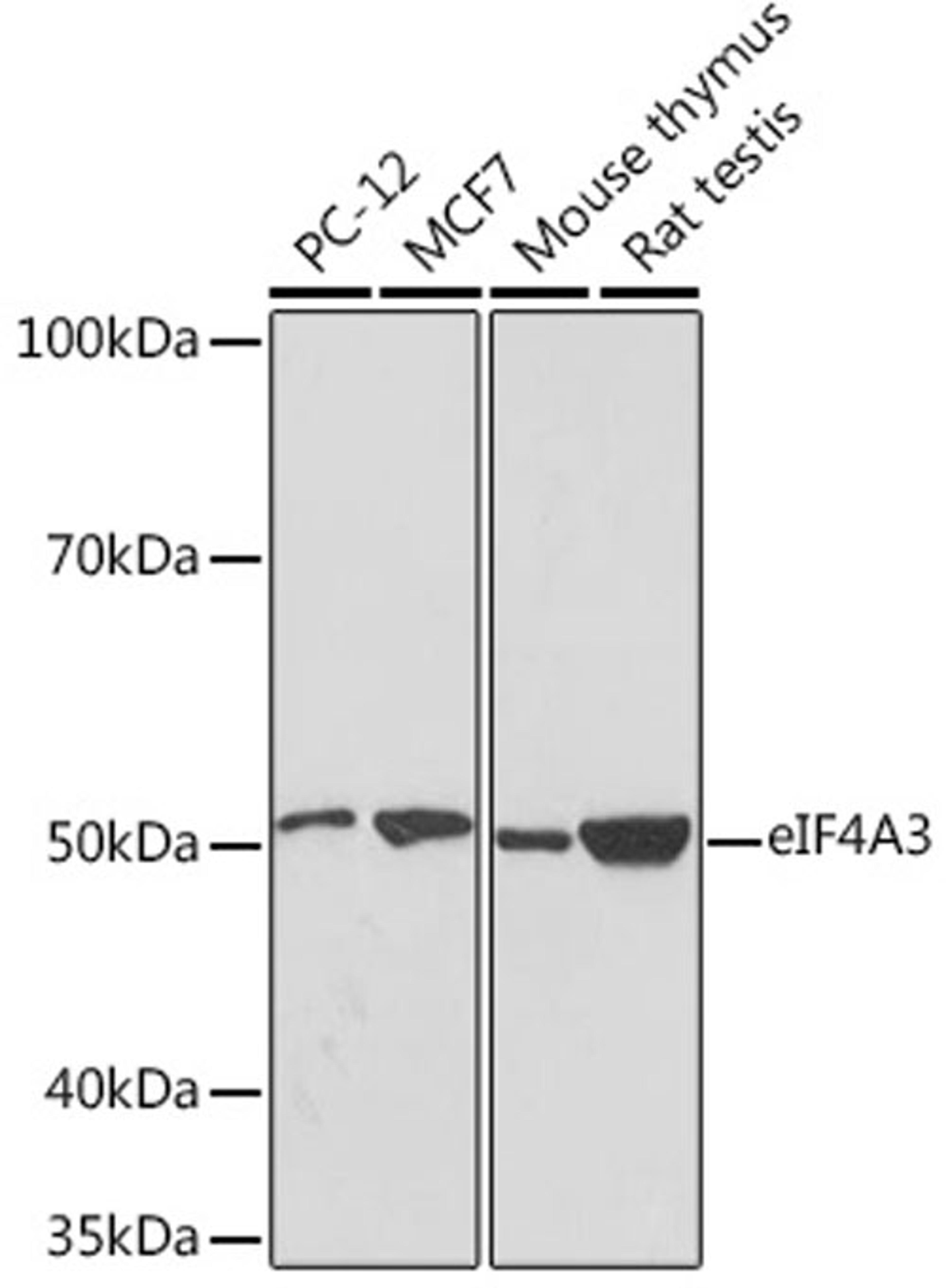 Western blot - eIF4A3 Rabbit mAb (A8985)