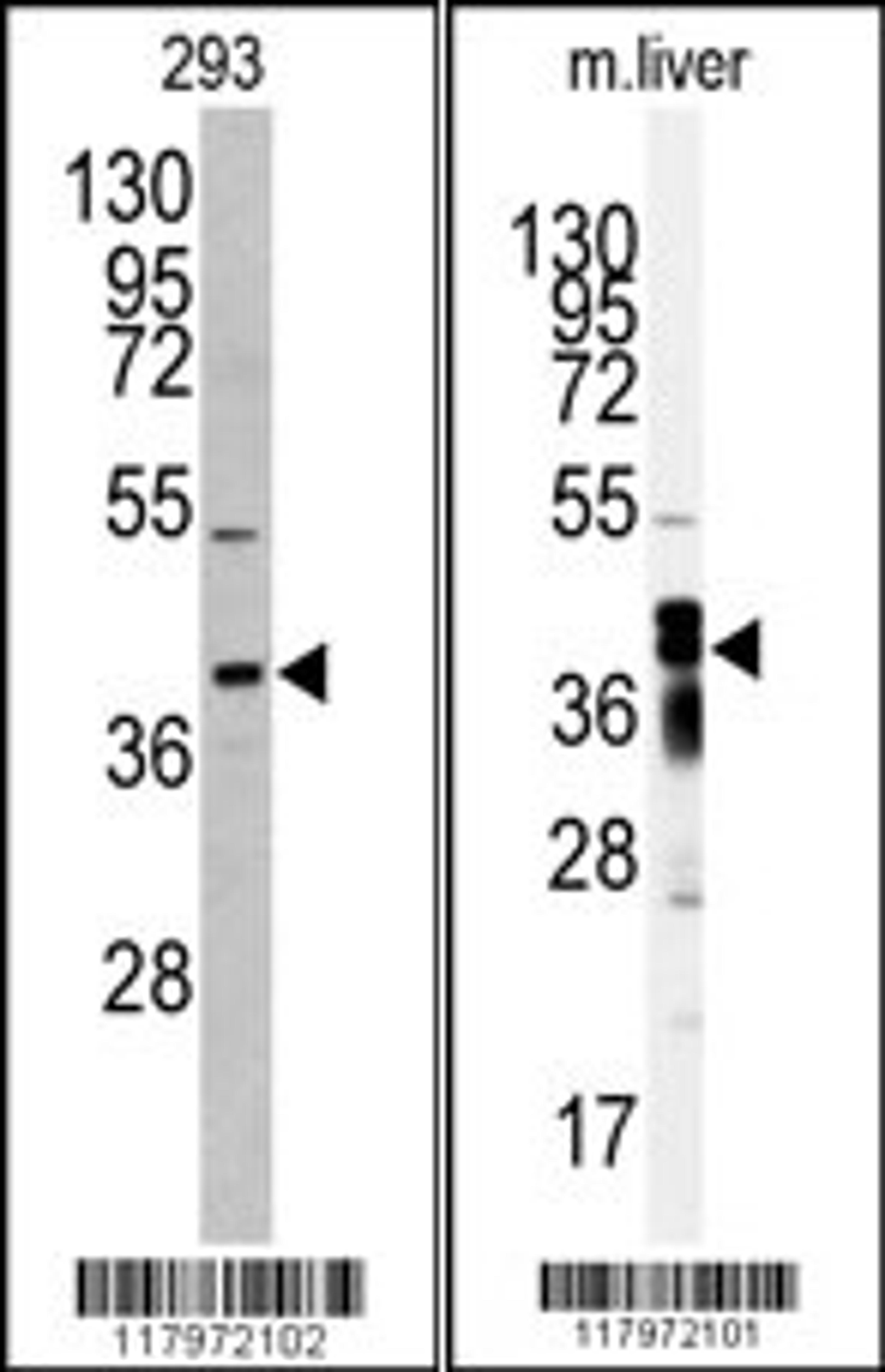 Western blot analysis of anti-AKR7A2 antibody in 293 cell line lysates (35ug/lane) Western blot analysis of anti-AKR7A2 Antibody in mouse liver tissue lysates (35ug/lane).