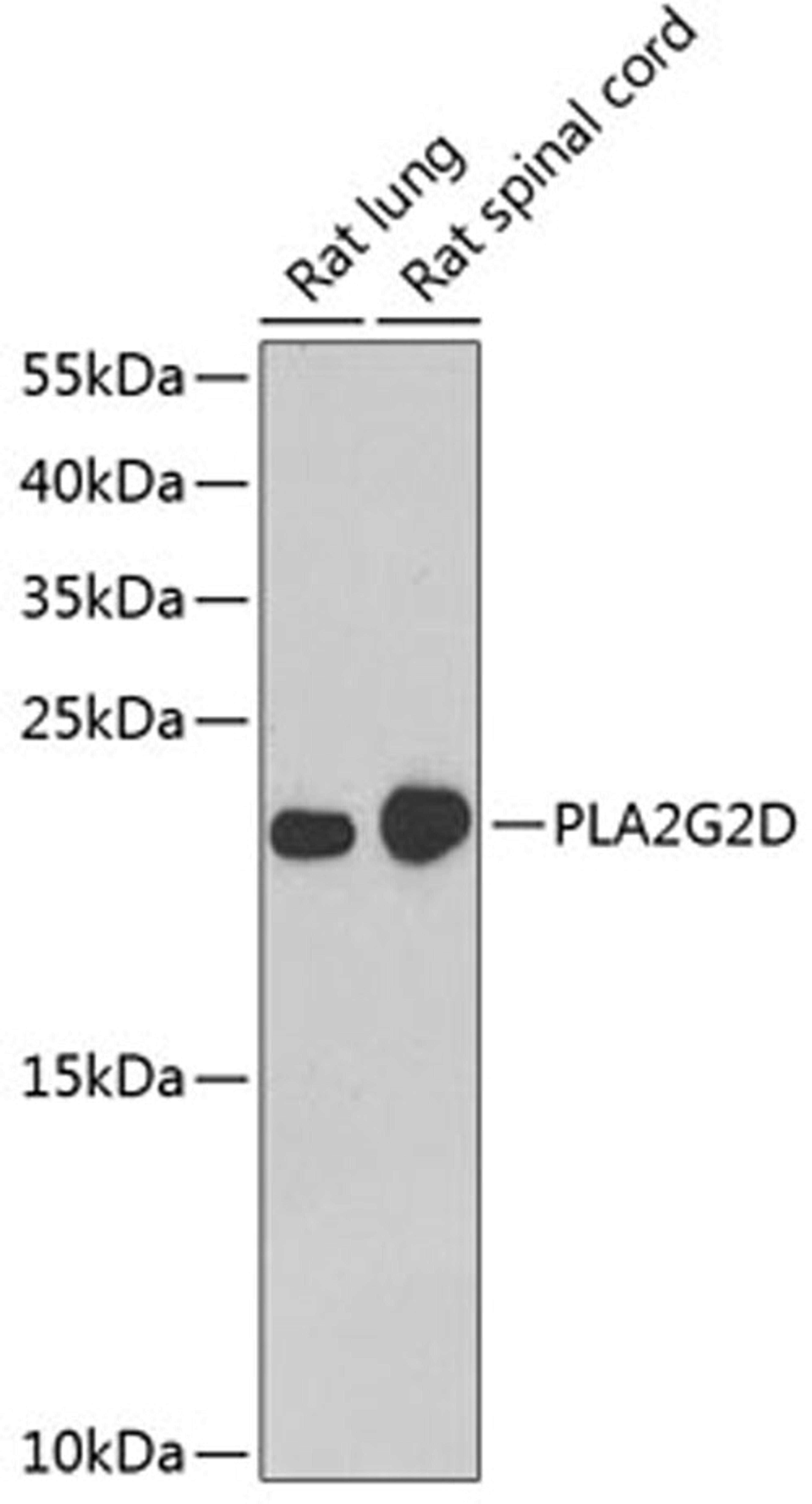 Western blot - PLA2G2D antibody (A7165)