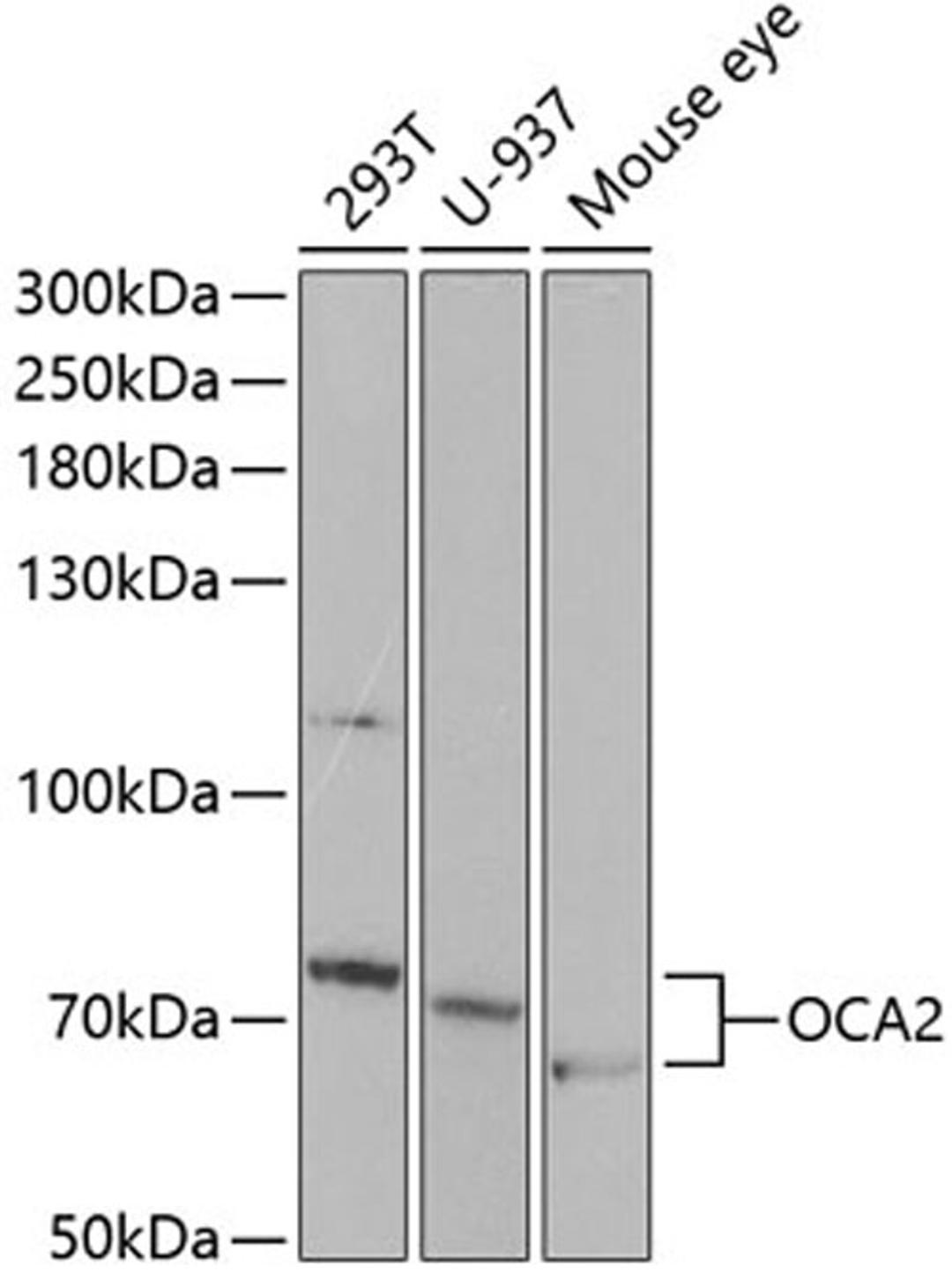 Western blot - OCA2 antibody (A5653)