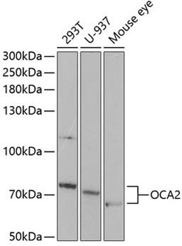 Western blot - OCA2 antibody (A5653)