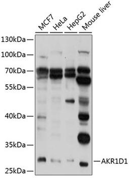 Western blot - AKR1D1 antibody (A9586)