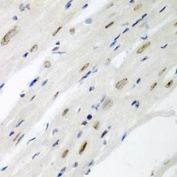 Immunohistochemical staining of human colon carcinoma tissue using CDC27 antibody (dilution of 1:200)