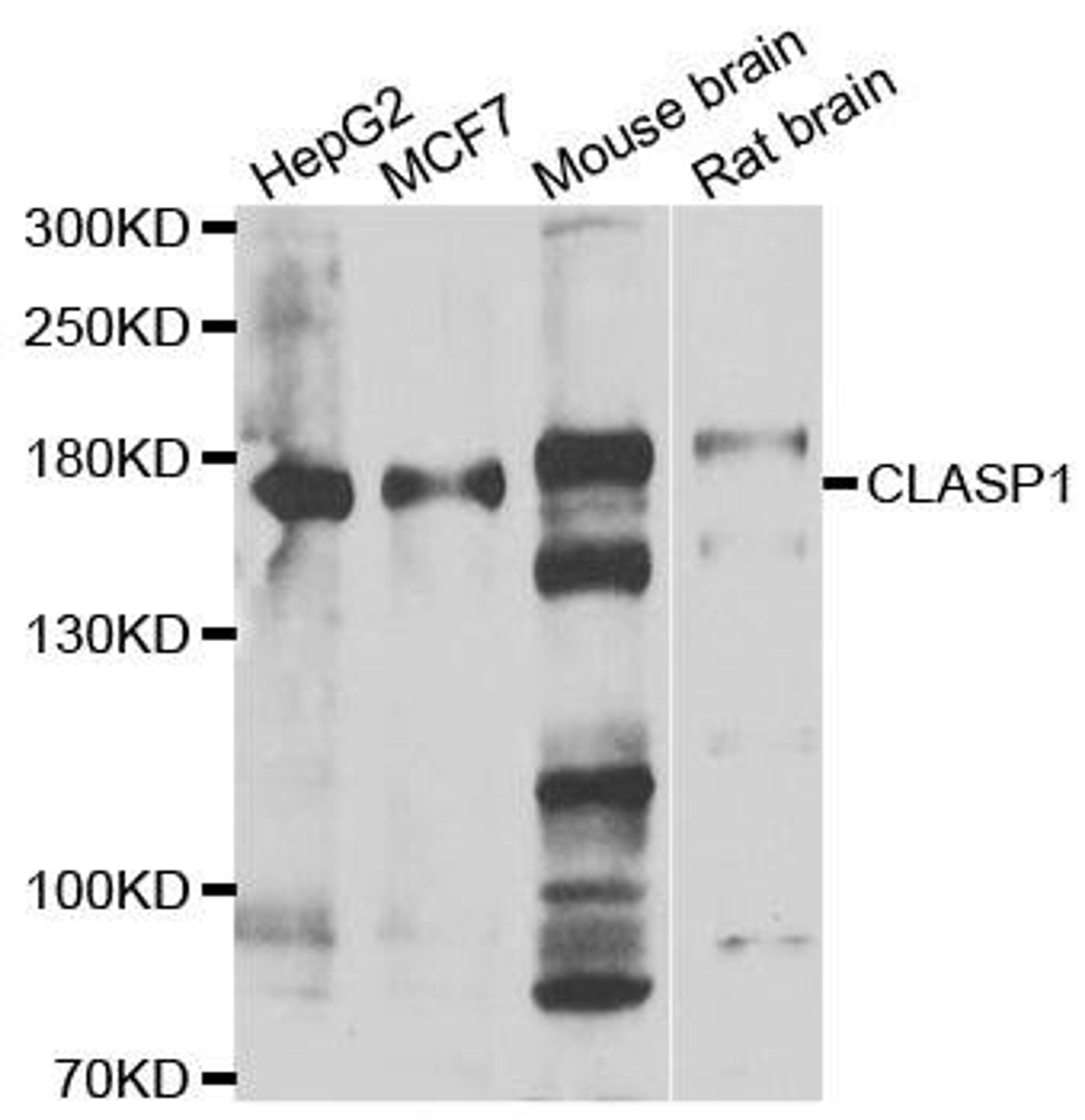 Western blot analysis of extracts of various cell lines using CLASP1 antibody