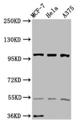 Western Blot. Positive WB detected in: MCF-7 whole cell lysate, Hela whole cell lysate, A375 whole cell lysate. All lanes: EIF3C antibody at 3.4ug/ml. Secondary. Goat polyclonal to rabbit IgG at 1/50000 dilution. Predicted band size: 106, 105 kDa. Observed band size: 106 kDa. 