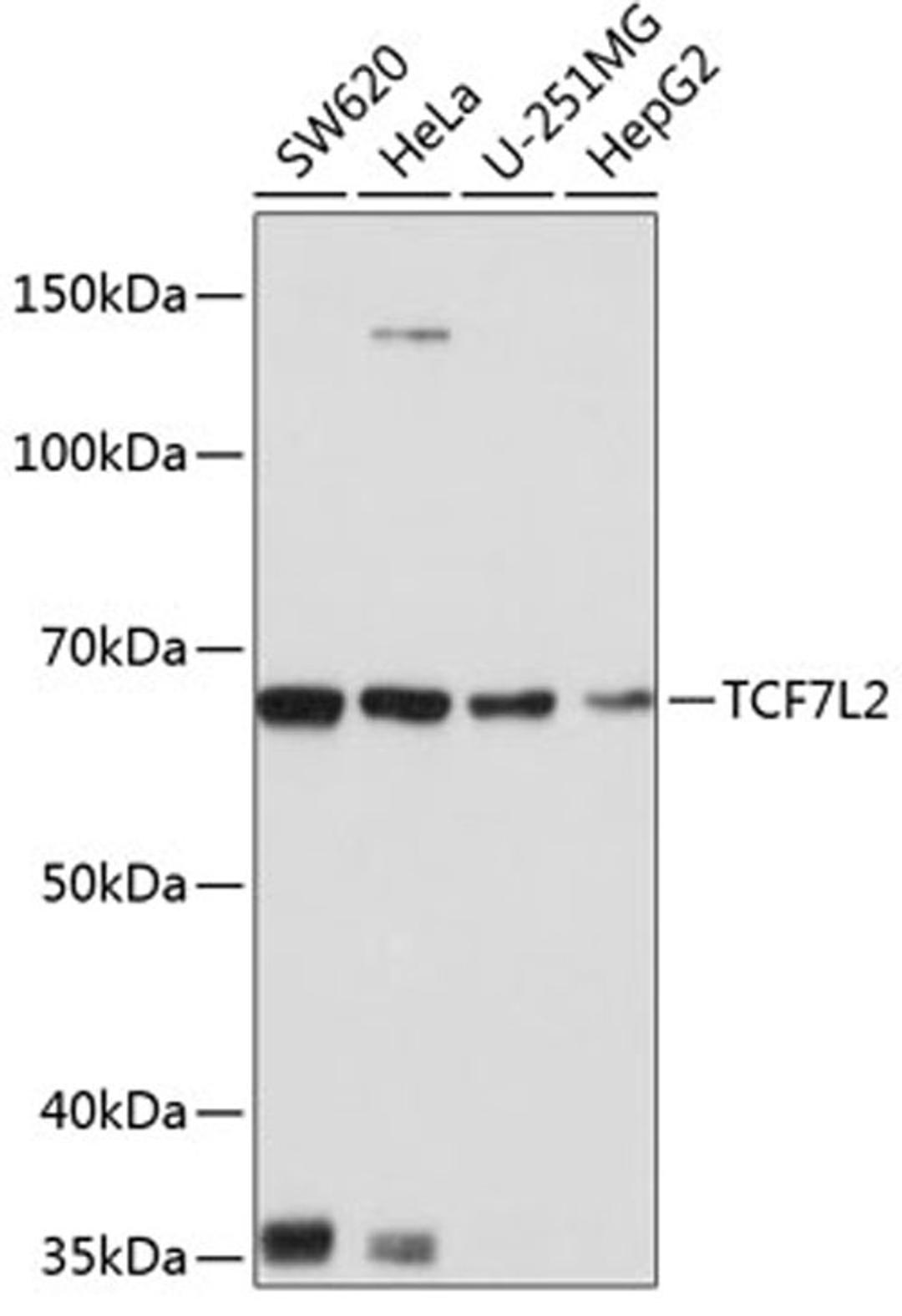 Western blot - TCF7L2 antibody (A19548)