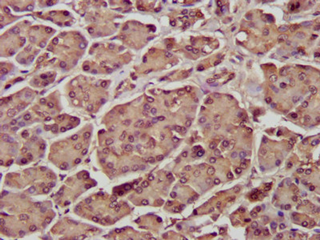 IHC image of CSB-PA020897LA01HU diluted at 1:300 and staining in paraffin-embedded human pancreatic tissue performed on a Leica BondTM system. After dewaxing and hydration, antigen retrieval was mediated by high pressure in a citrate buffer (pH 6.0). Section was blocked with 10% normal goat serum 30min at RT. Then primary antibody (1% BSA) was incubated at 4°C overnight. The primary is detected by a biotinylated secondary antibody and visualized using an HRP conjugated SP system.