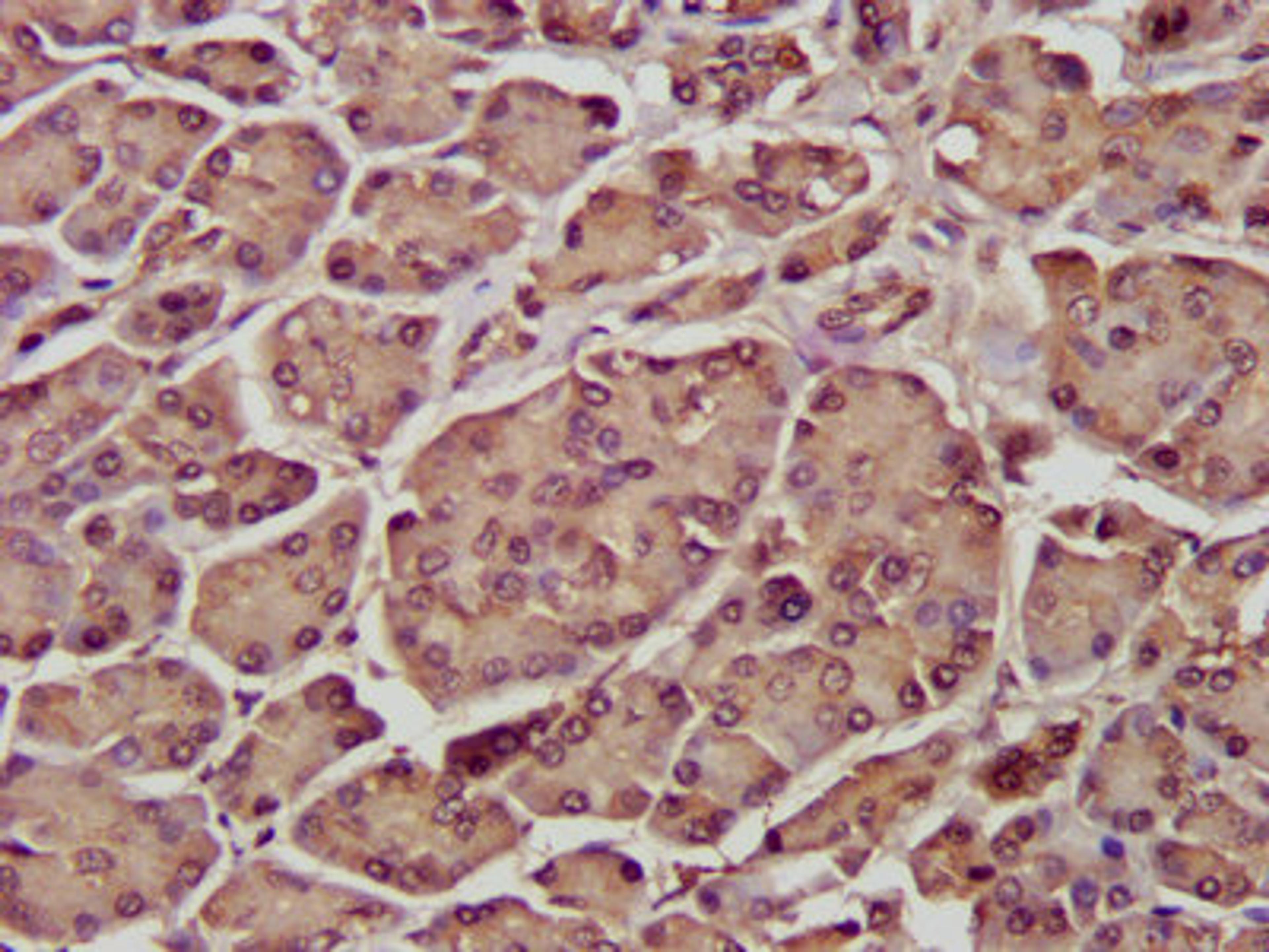 IHC image of CSB-PA020897LA01HU diluted at 1:300 and staining in paraffin-embedded human pancreatic tissue performed on a Leica BondTM system. After dewaxing and hydration, antigen retrieval was mediated by high pressure in a citrate buffer (pH 6.0). Section was blocked with 10% normal goat serum 30min at RT. Then primary antibody (1% BSA) was incubated at 4°C overnight. The primary is detected by a biotinylated secondary antibody and visualized using an HRP conjugated SP system.
